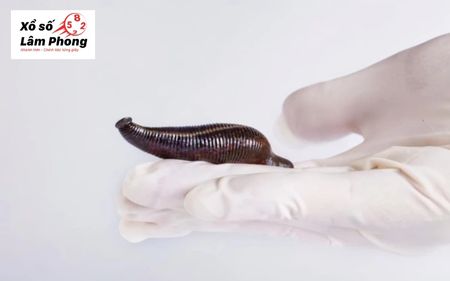 Mơ thấy đỉa cắn