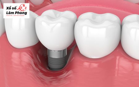 Ý nghĩa chung khi nằm mơ thấy rụng răng hàm dưới không chảy máu