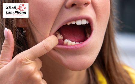 Nằm mơ thấy rụng răng hàm dưới không chảy máu: Số gì, điềm gì?